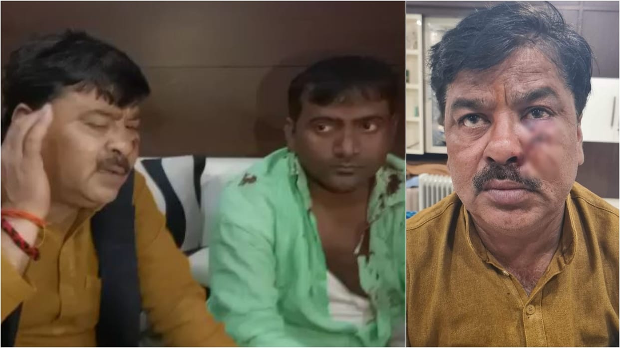 UP Election 2022 Samajwadi Party MLA raju yadav injured in attack during voting in Mainpuri