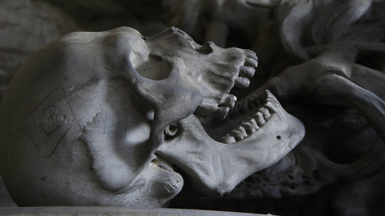 Archaeologists Found this Evidence of Thousands of Years ago Ear Surgery