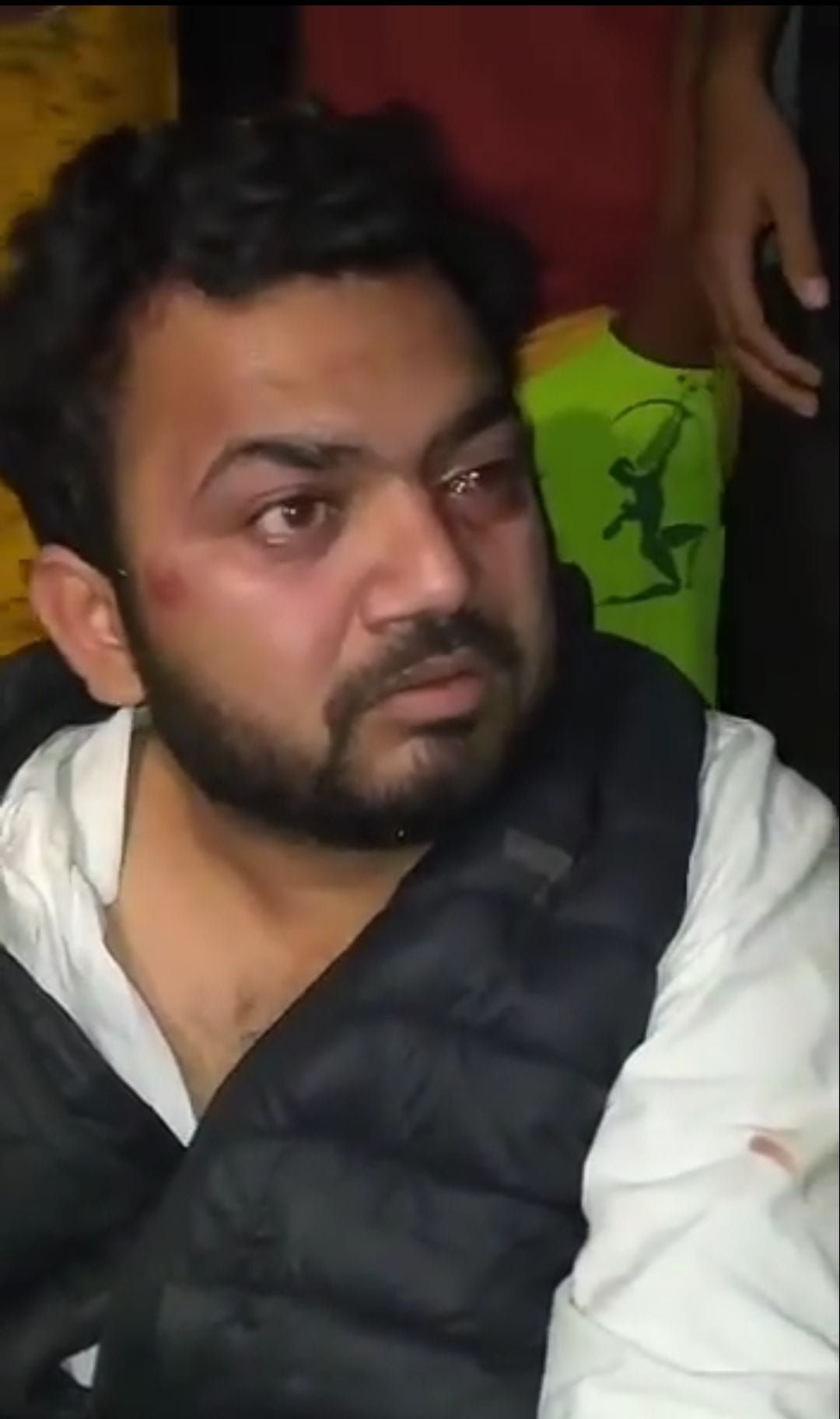 The son of the municipality was attacked, beaten up in the house of the councilor