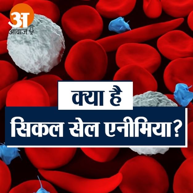 how to fight from Sickle Cell Anemia?