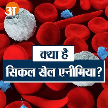 सिकल सेल एनेमिया