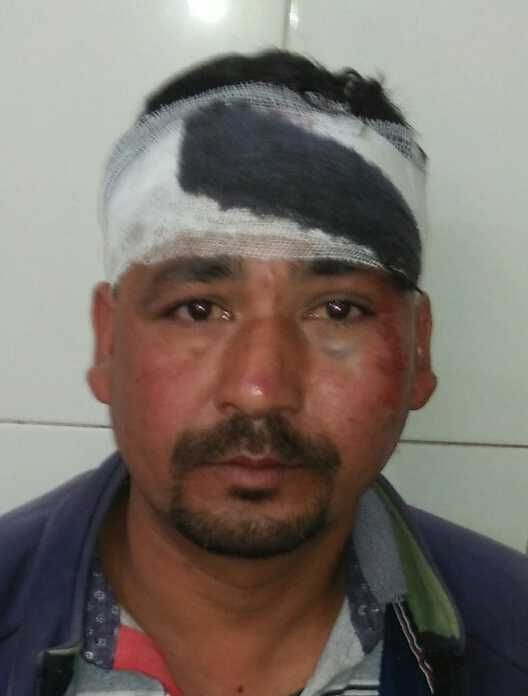 Accident in Dafaut Road Bageshwar
