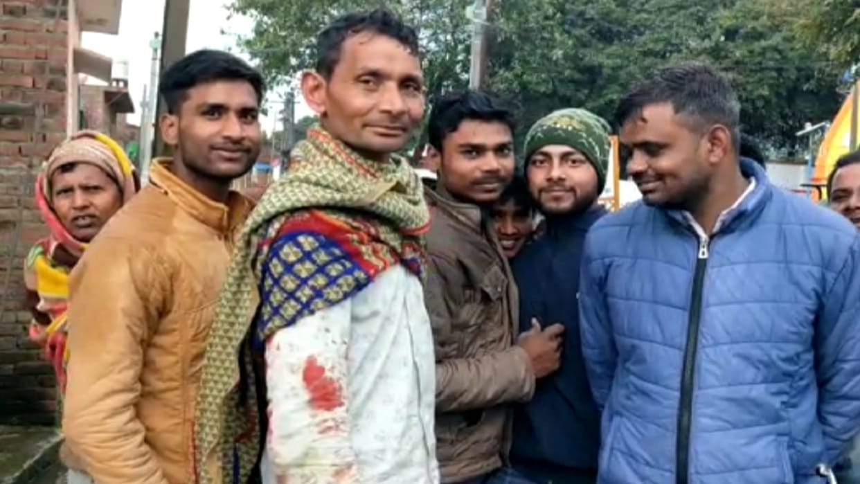 Leopard attack on farmer in Amroha of uttar pradesh