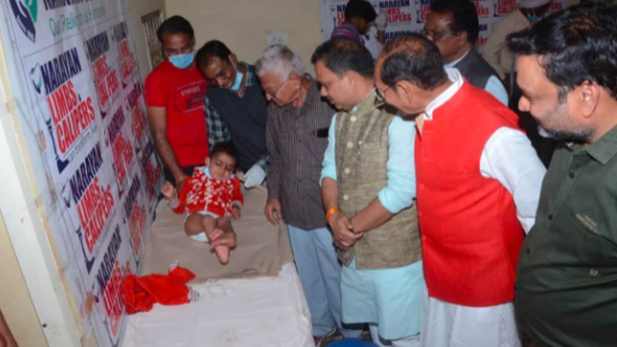 Divyang Testing Camp in Shivpuri: 409 Divyang arrived, 70 selected for operation, 100 will be given artificial limbs