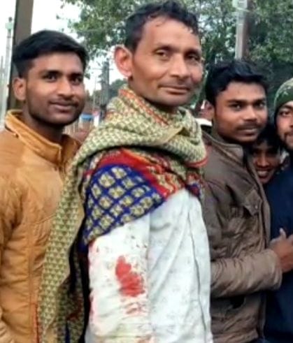 Leopard attacked farmer working in the field