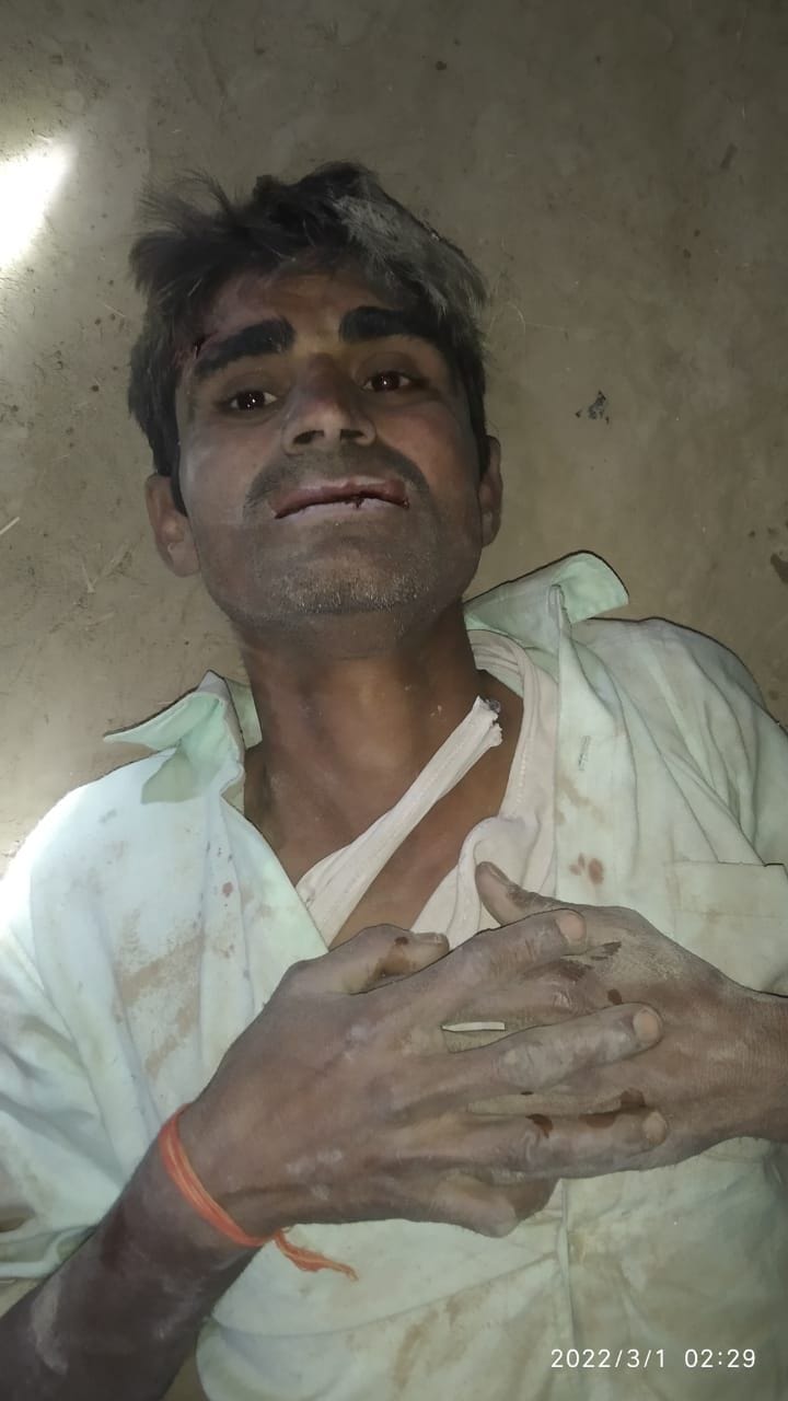 hathras : Caught the miscreants carrying a sack of potatoes
