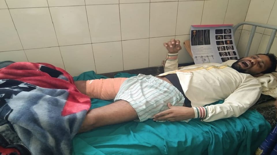 in a hospital in agra patient had problem with left leg doctor operated on the right leg
