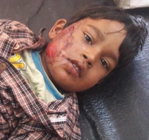 Hathras: Two brothers going to school were hit by a tractor-trolley, one dead