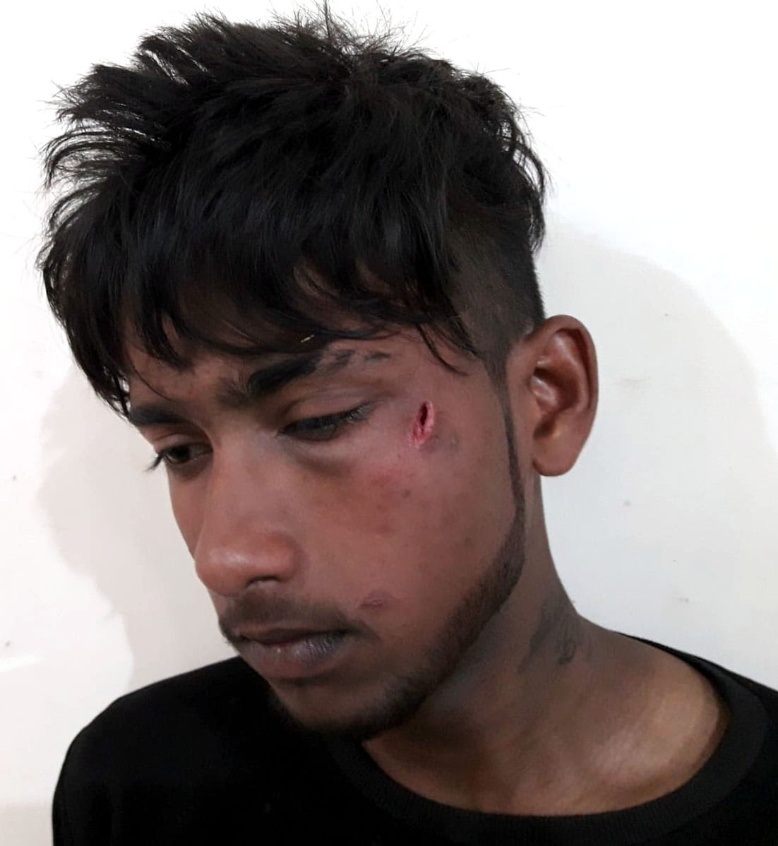 Two youths were injured by stabbing