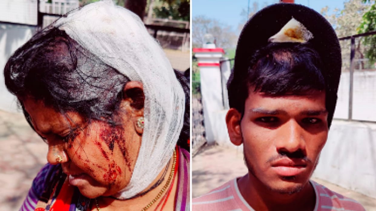 Chhatarpur: Controversy over buying goats, fatal attack on woman, complaint in SP office