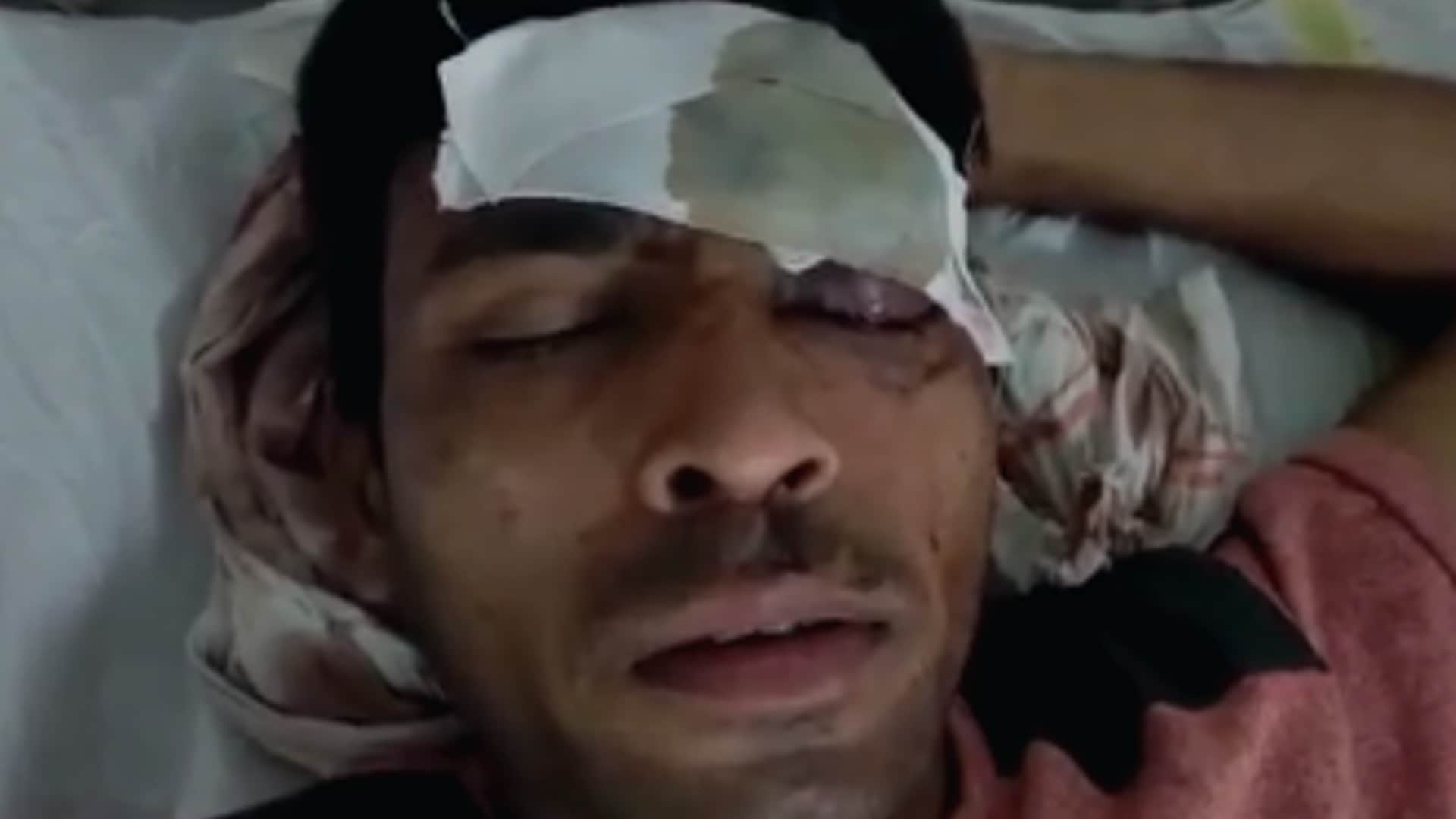 Chhatarpur: Accusations on BJP MLA - The house of Shukla family was set on fire for grabbing land, beat up the whole family