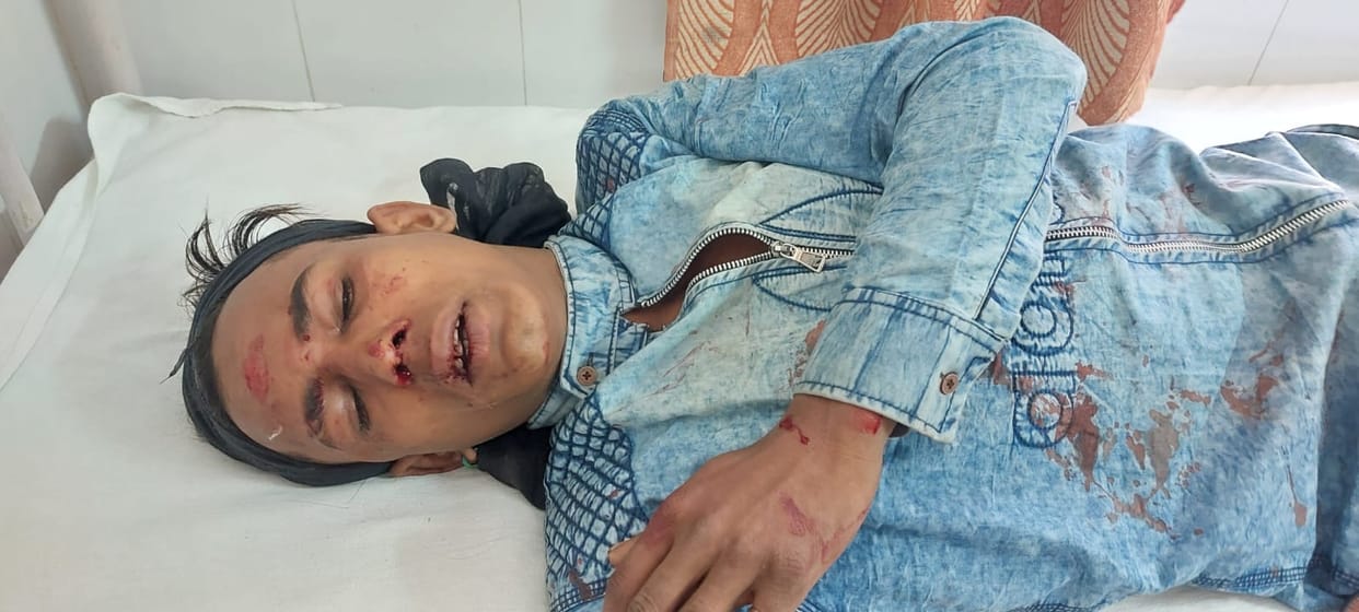 Two killed, one injured in road accidents