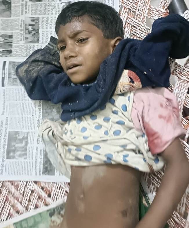 Girl injured in dog attack