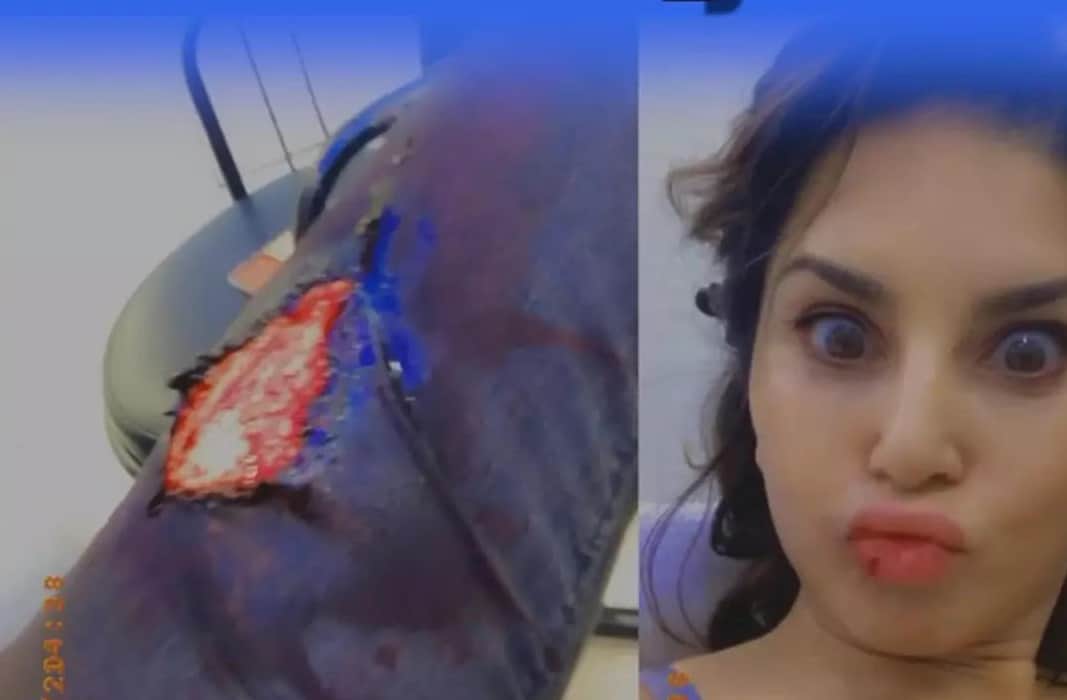 sunny leone injured during shooting, watch viral video of anamika web series behind the scenes
