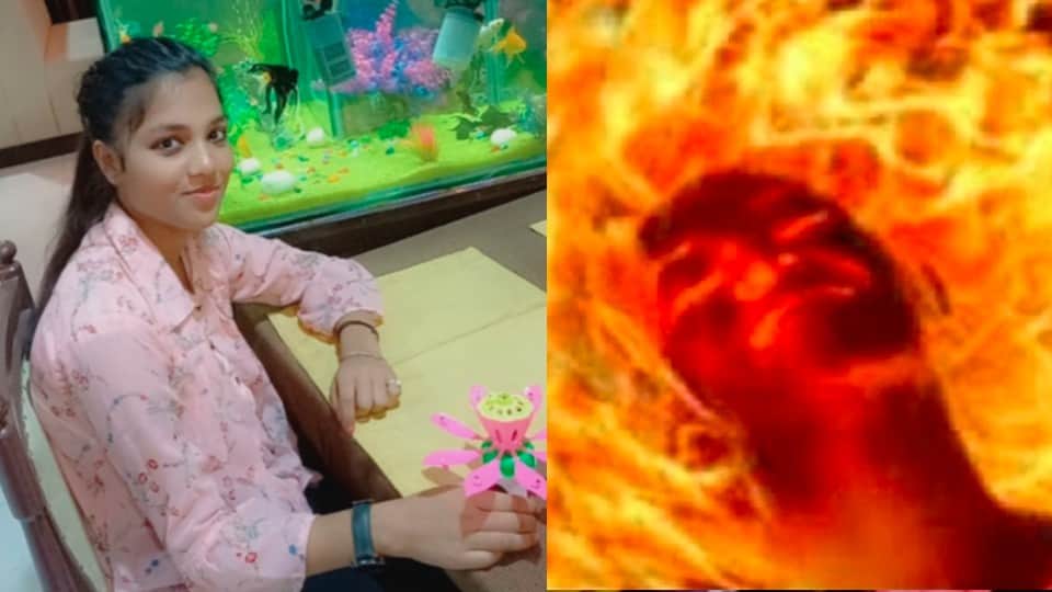 Chhatarpur: Minor student set fire by pouring kerosene, Gwalior referrer, reason behind the incident being told mobile