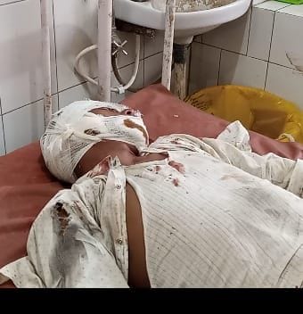 Hathras: Scooty hit the bike from behind, bike rider injured