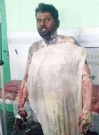 Youth set fire in Gauriphanta Kotwali, Kotwal suspended