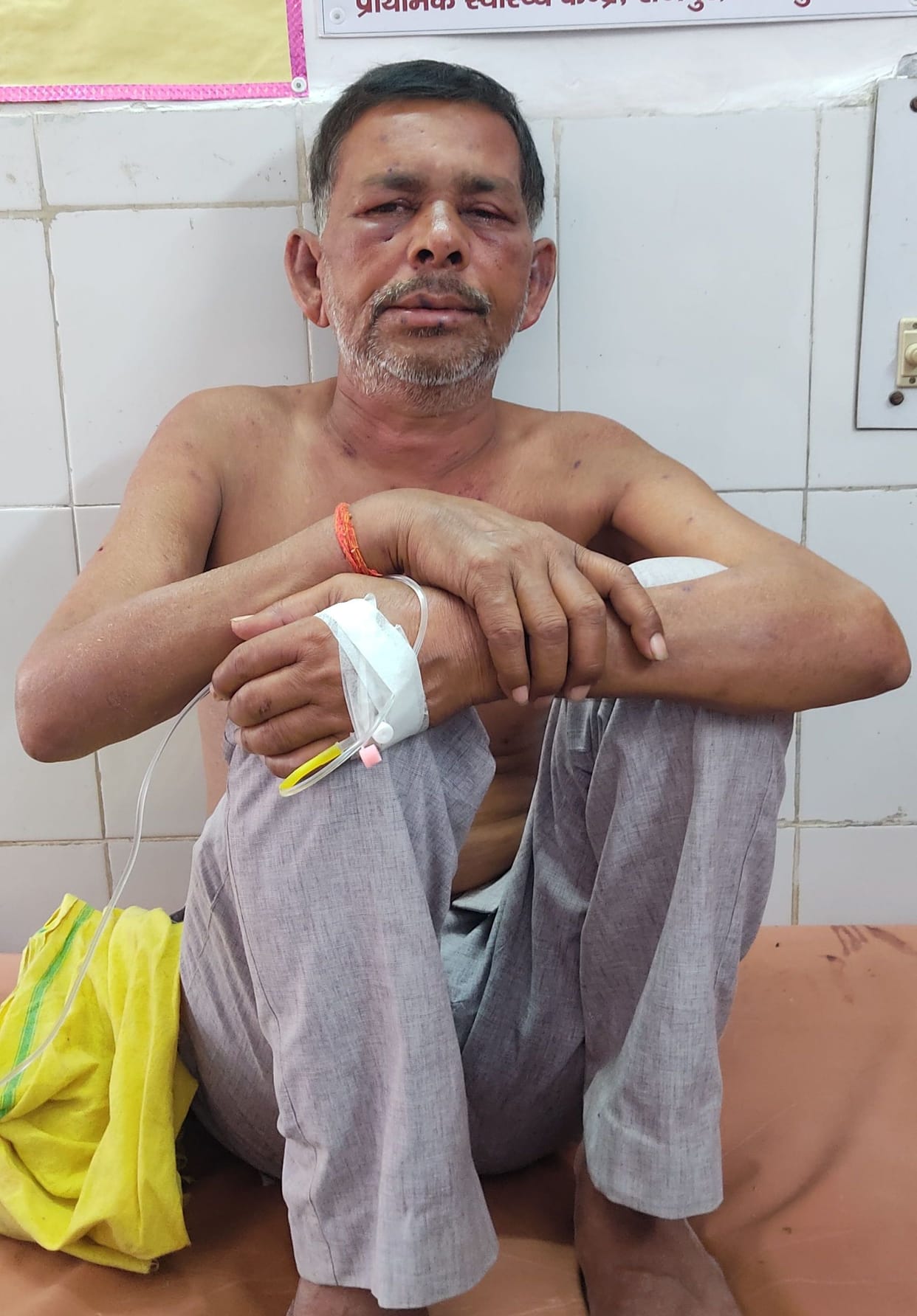 Kanpur Dehat: Smoke reached the hive during Havan, 50 people injured in bee attack