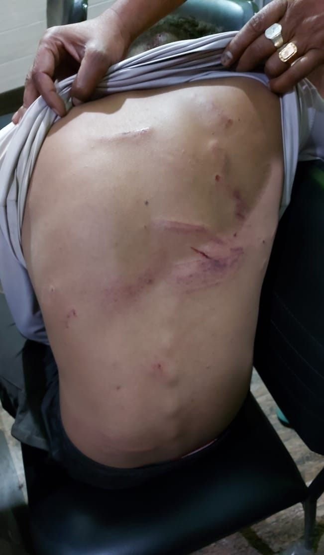 Attack on a young man who went to take fodder on the farm