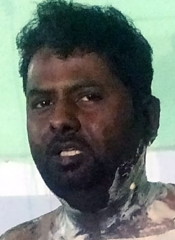 Death of a young man who tried to immolate himself in Gauriphanta Kotwali