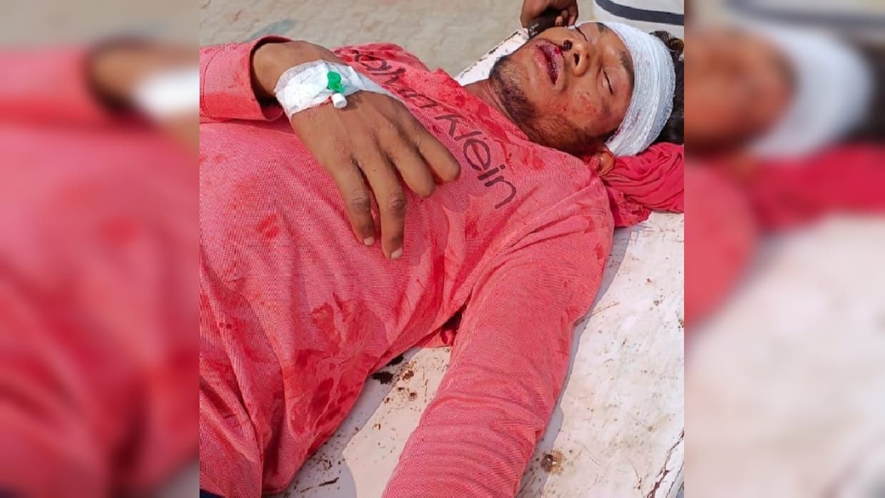 Youth attacked with shovel in old enmity Gorakhpur