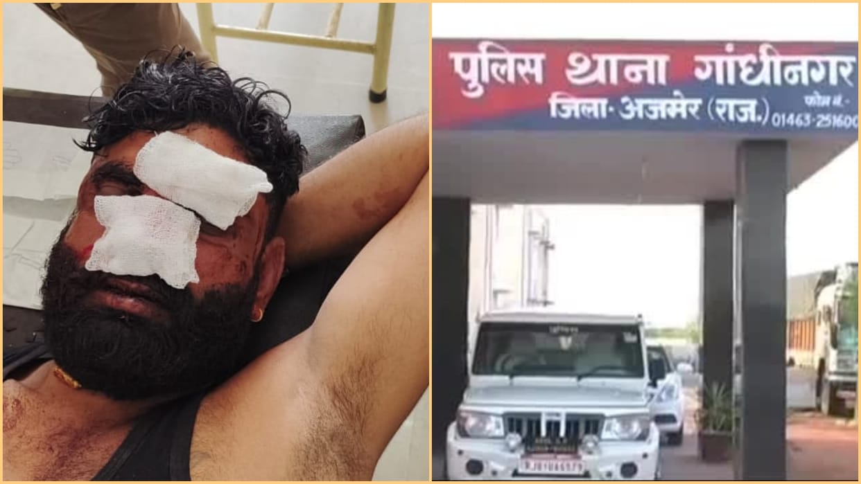 young man nose cut off with sharp weapon in a fight in Ajmer