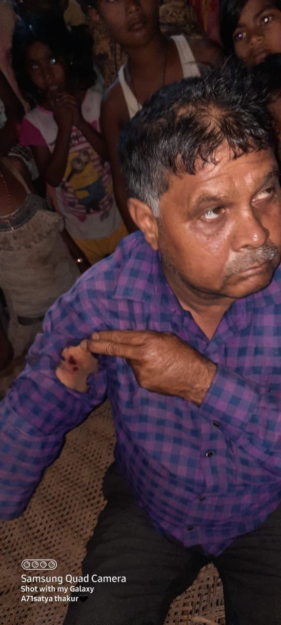 auraiya news,Father shot for opposing miscreants robbing daughter