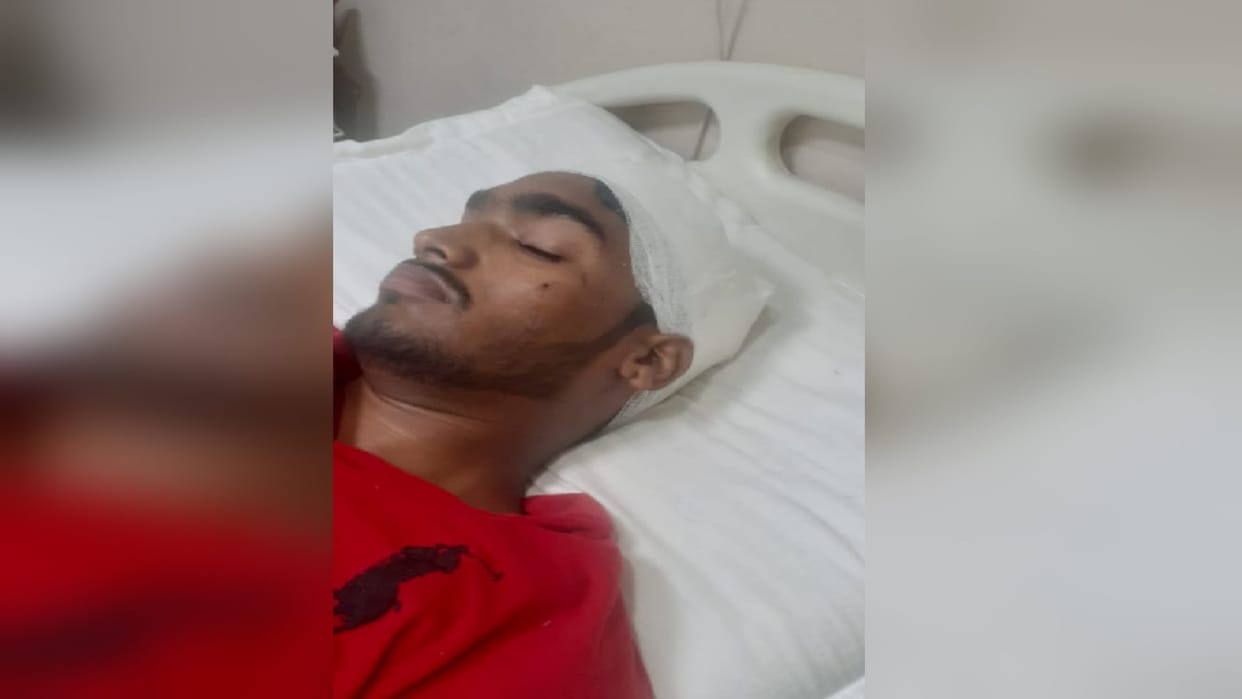Sir, I have had an accident, I am lying on the road, B.Tech student injured after a tempo overturn calls Dean