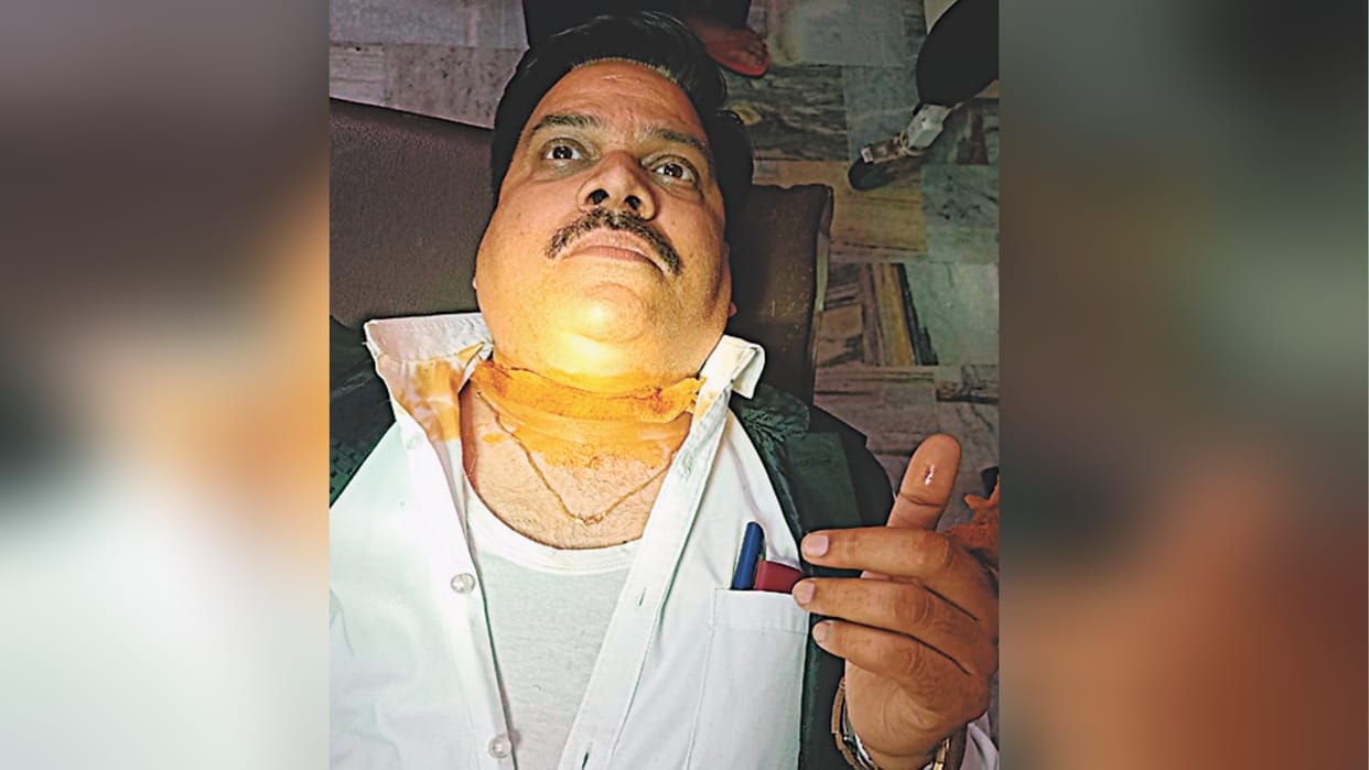 Advocate neck bled with Chinese Manjha in Meerut, teenager scorched