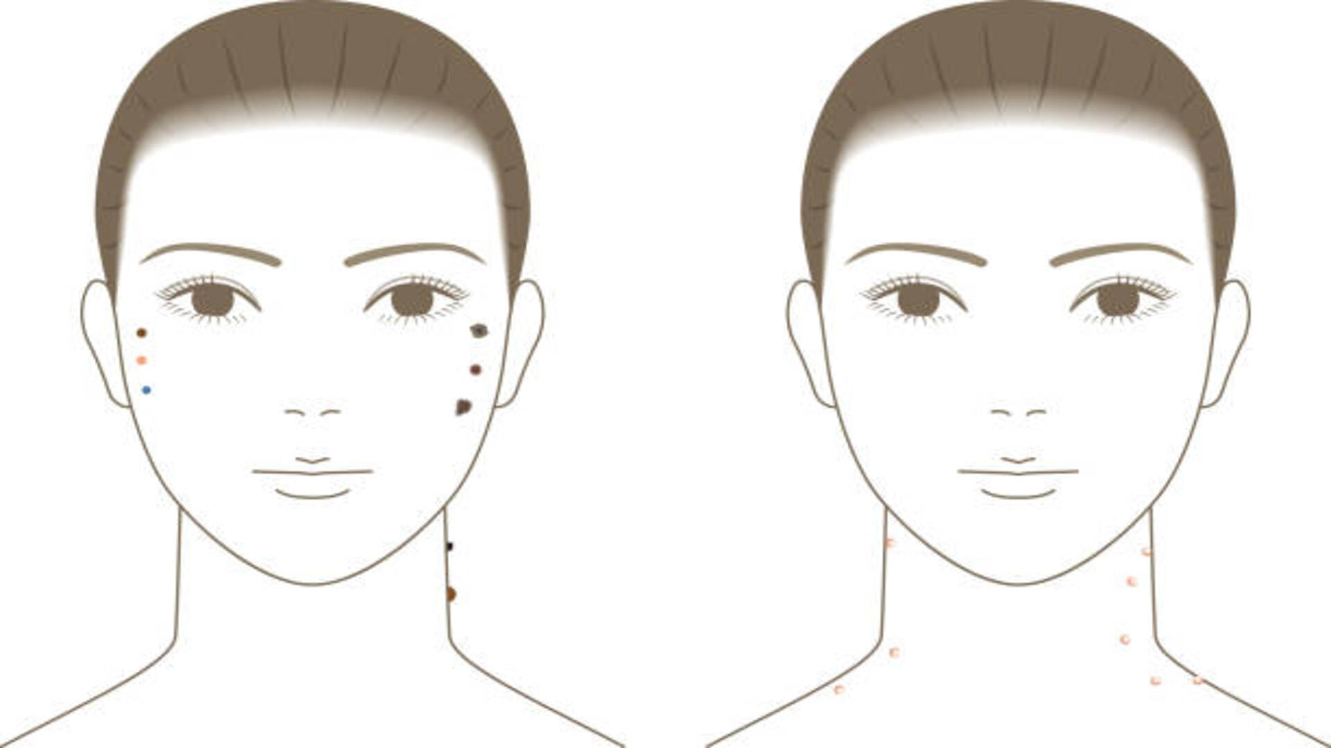 Moles On Body Meaning Face Nose Lips Legs Sharir Par Til Ka Matlab In Hindi