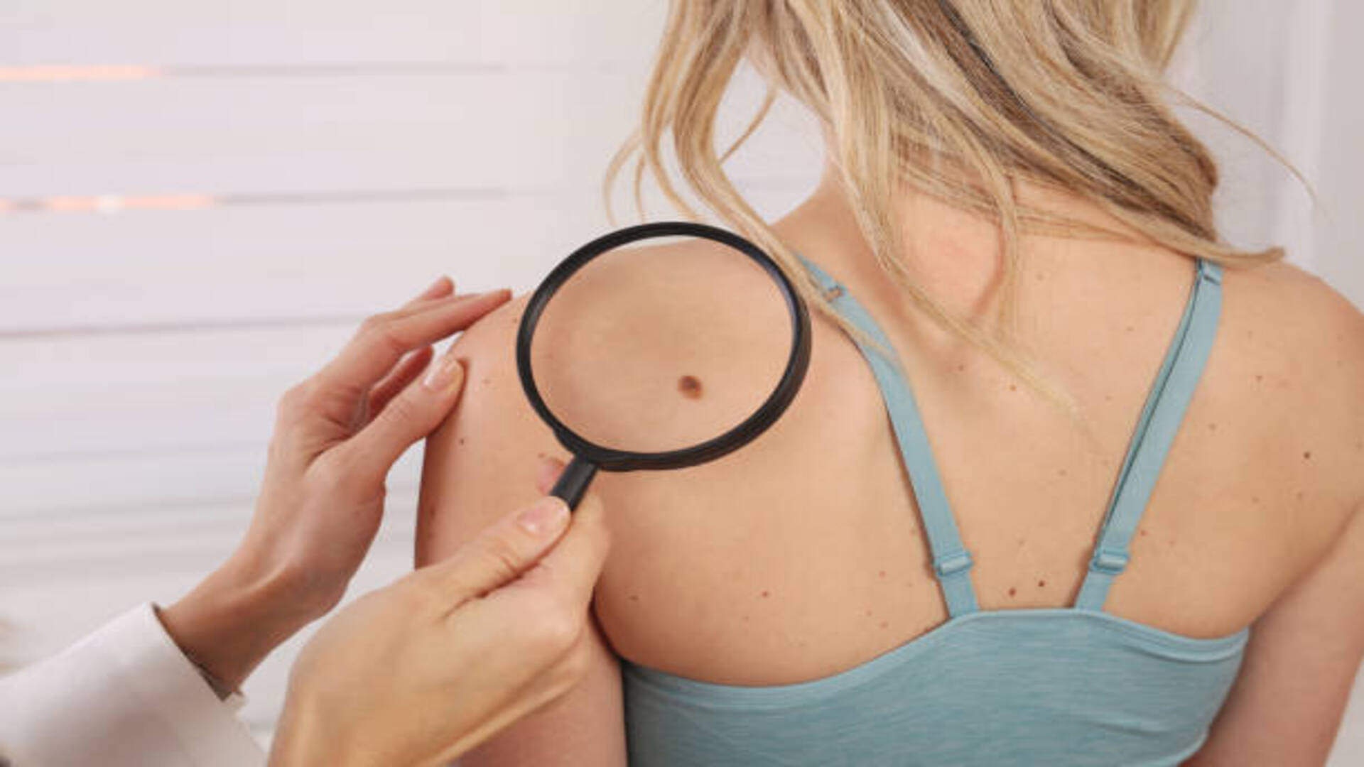 lucky moles on female body In Hindi according to Samudrik Shastra