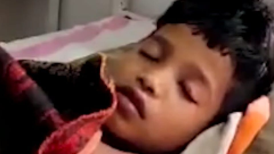 Accident in Betul: The intestines came out of the child's stomach due to the explosion of the mobile battery, the child was playing with the battery found on the road