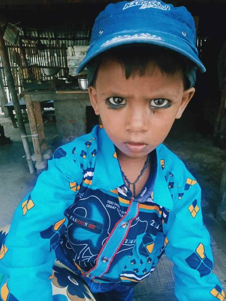 Scorched child dies due to fire in the hut
