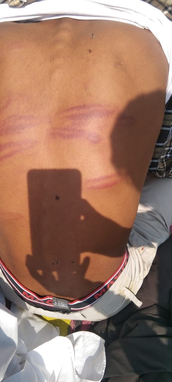 Principal bans minor student's school admission, alleging beating by complaining to DSP