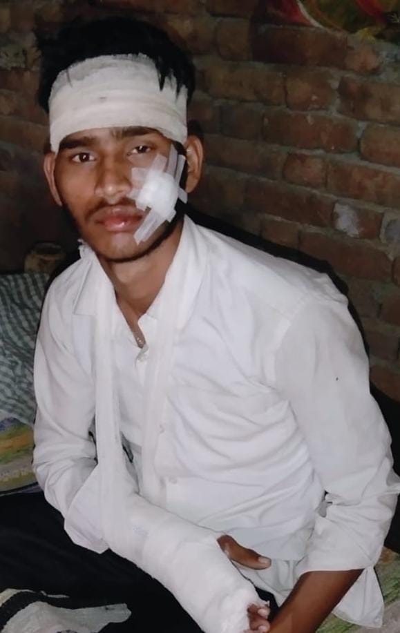 Hathras: Three bike riders injured in Bolero collision