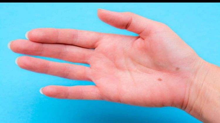 mole-on-palm-meaning-in-hindi-hatheli-par-til-ka-matlab-kya-hota-hai