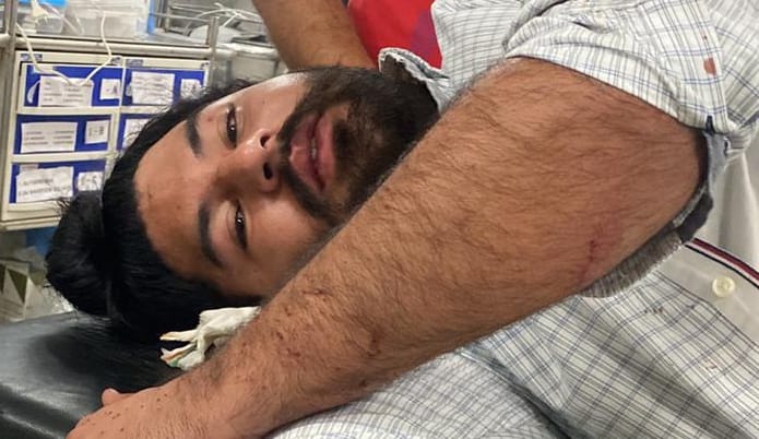 Shot fired at young man, injured due to shrapnel