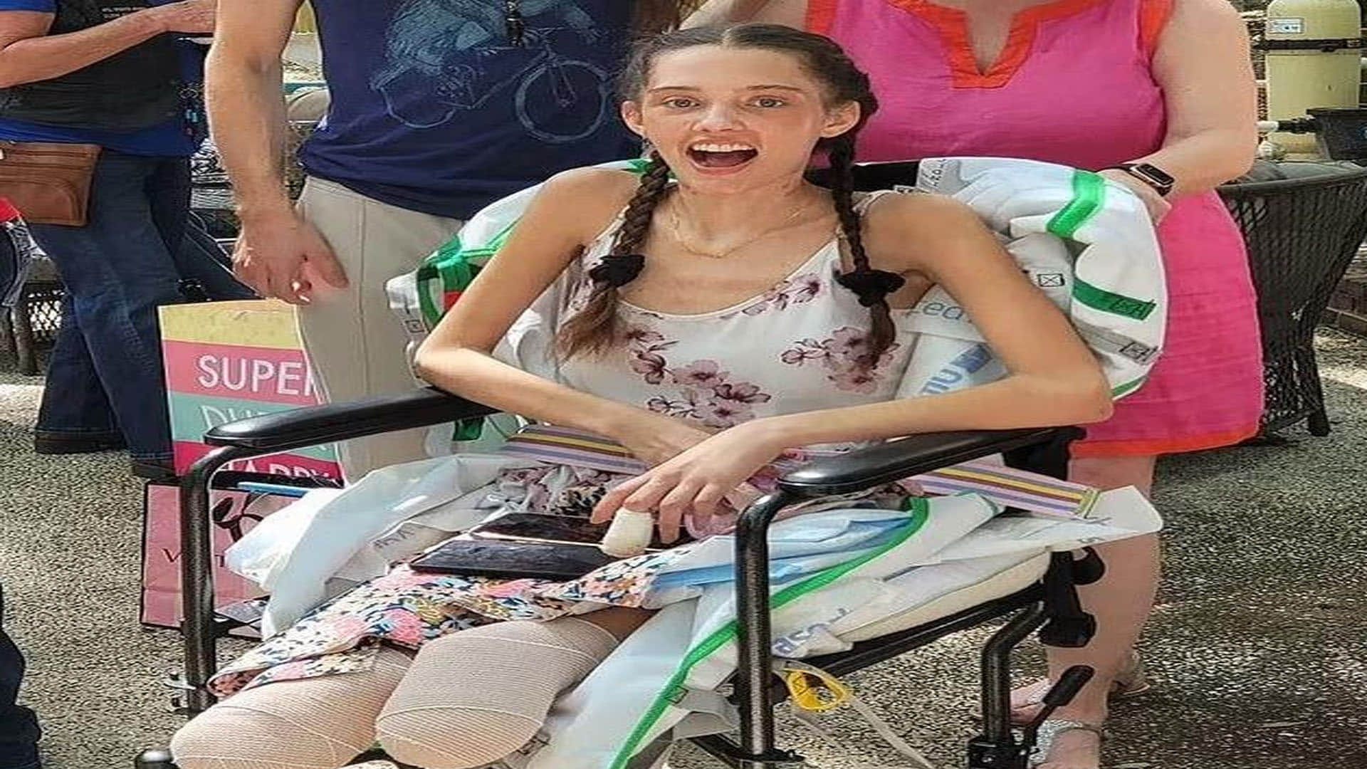 Model Both Legs Amputated After Getting Infected With Corona Happy and Celebrated Her Birthday