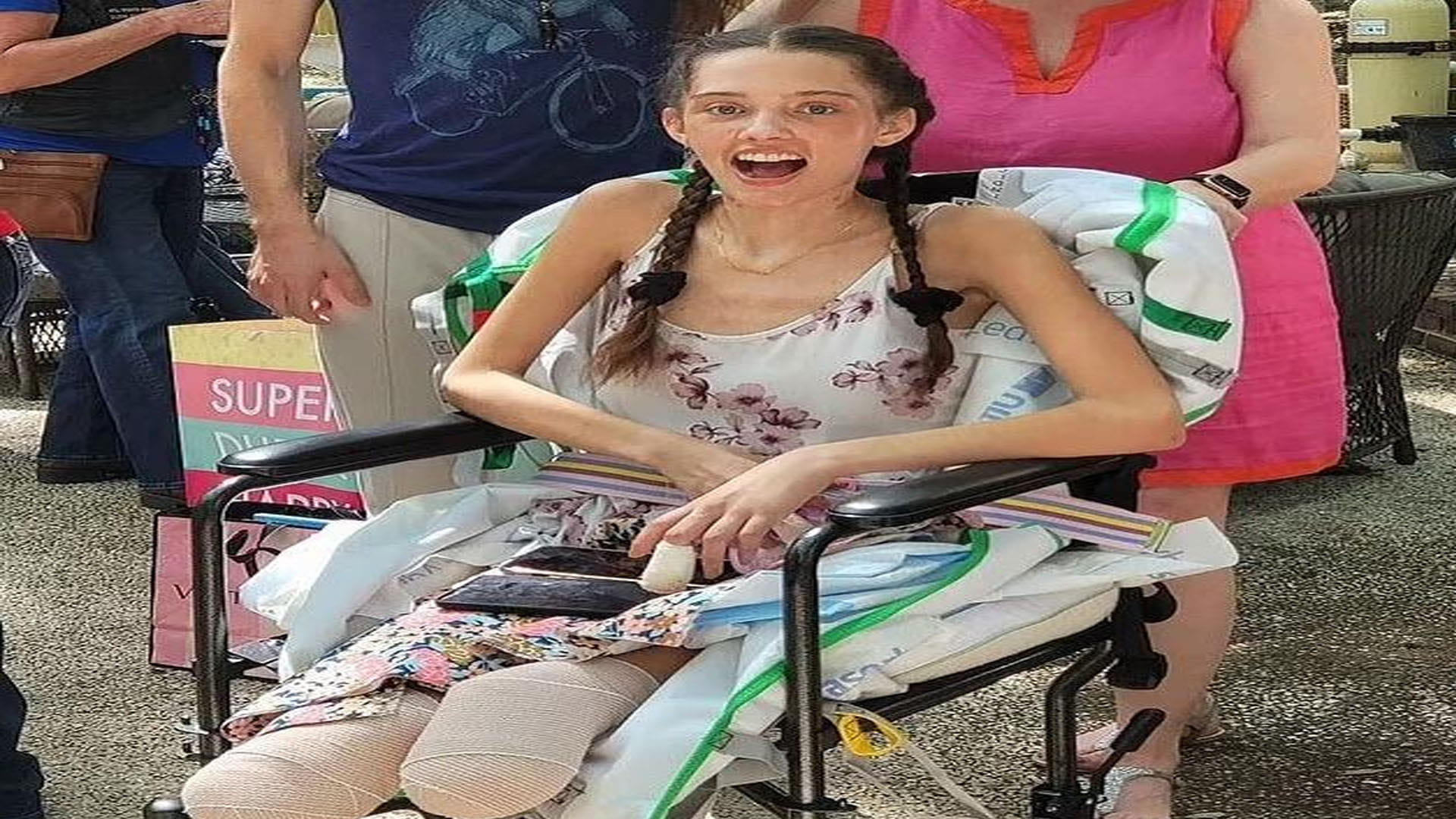 Model Both Legs Amputated After Getting Infected With Corona Happy and Celebrated Her Birthday