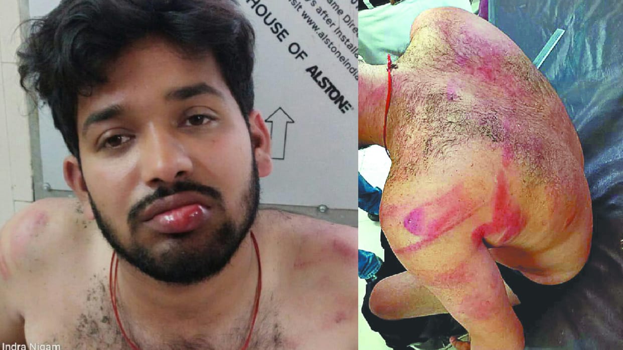 Youths showing stunts beat up BJP leader