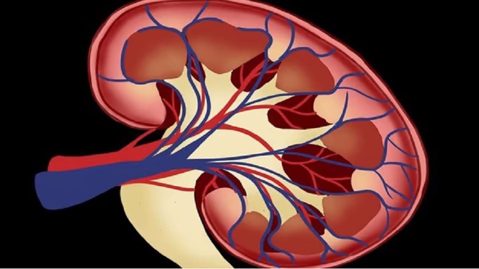 81-year-old mother gave kidney to her 56-year-old son, became the oldest kidney donor in the country