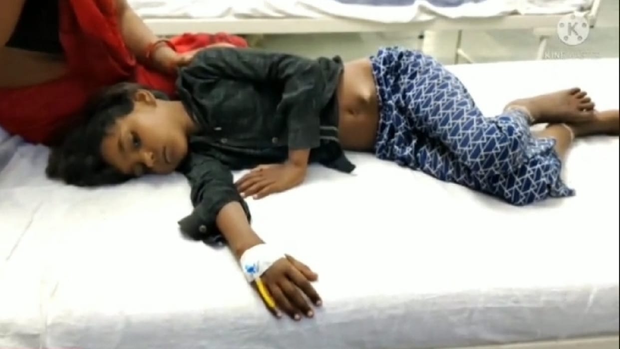 Chhatarpur: 7-year-old girl fell on the ground while playing, half a foot wooden piece entered in her stomach, was removed after operation