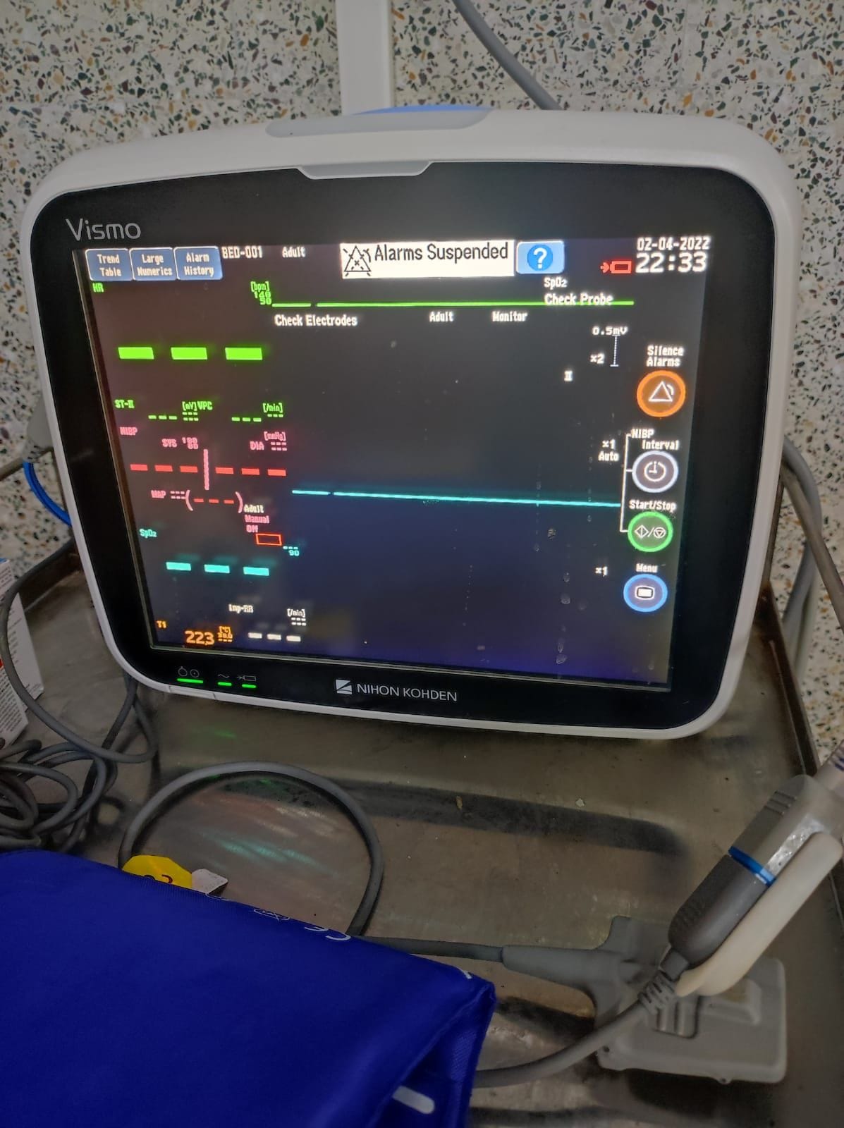 Amar Ujala Health Campaign: Teesa Hospital got 60 concentrates during the Corona period