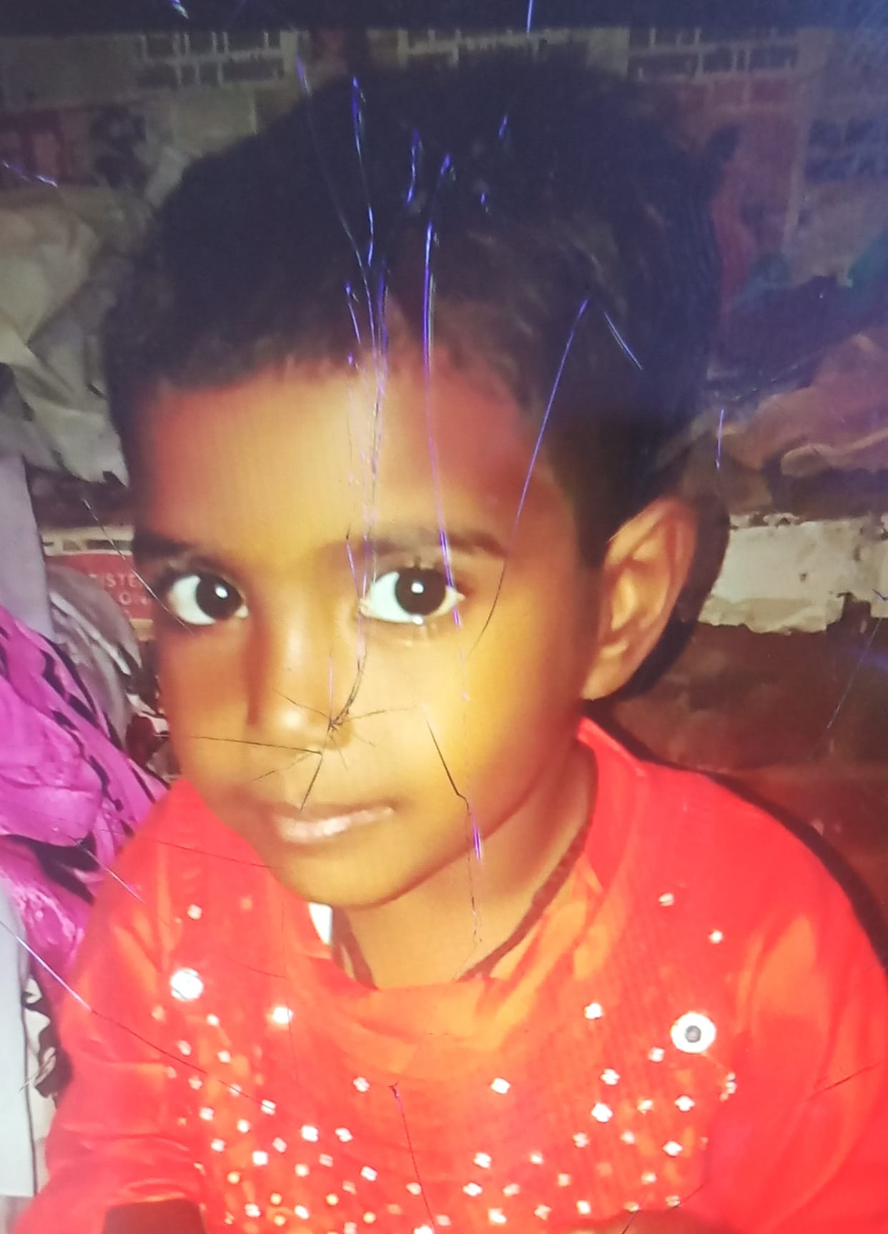 Child dies after eating samosa, four family members fall ill due to food poisoning