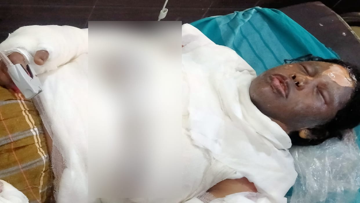 Bijnor: Husband first put red chilli powder in wife eyes, then set her on fire by putting diesel, condition critical