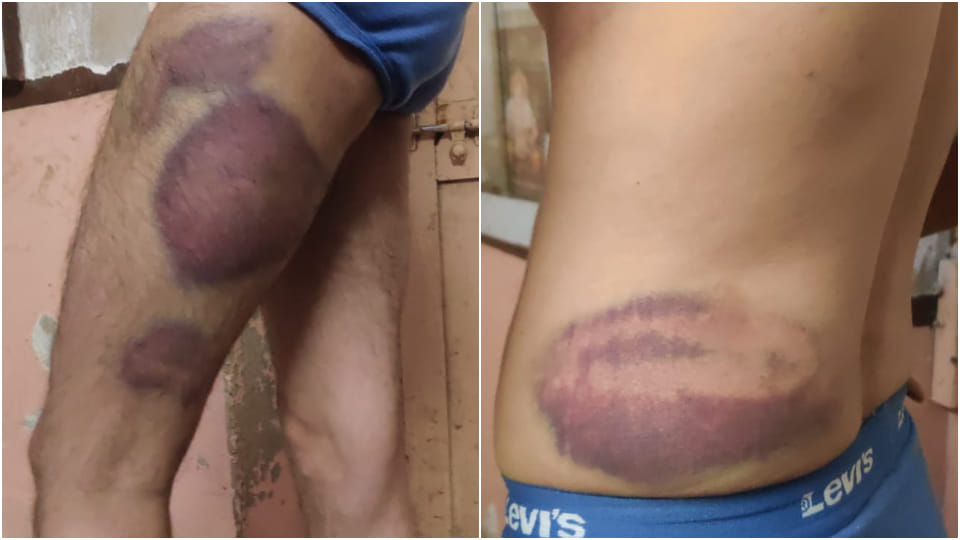 Policemen locked liquor businessman in lockup and beat him with kicks and bribes throughout night in Ajmer