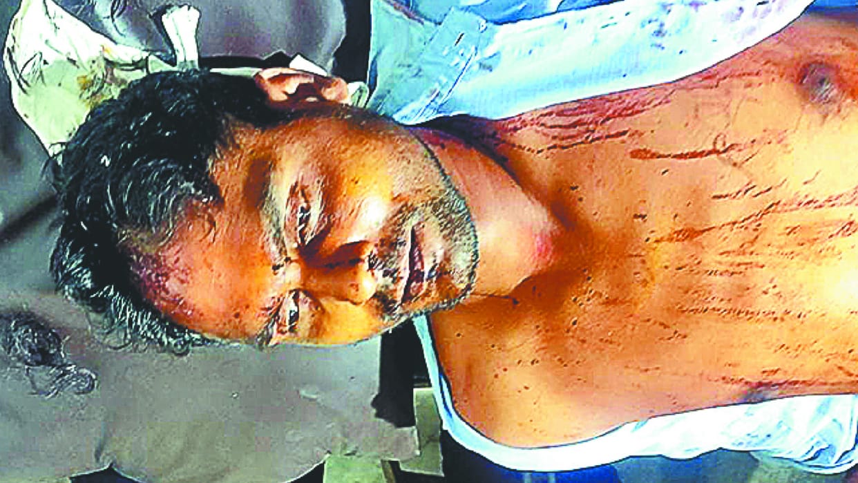 Controversy escalated over stopping SP leader from beating up