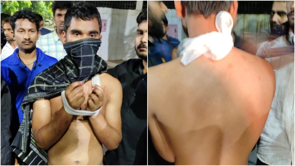 The student skin was torn apart while beating, said - if you complain, you will send him to jail in a fake case