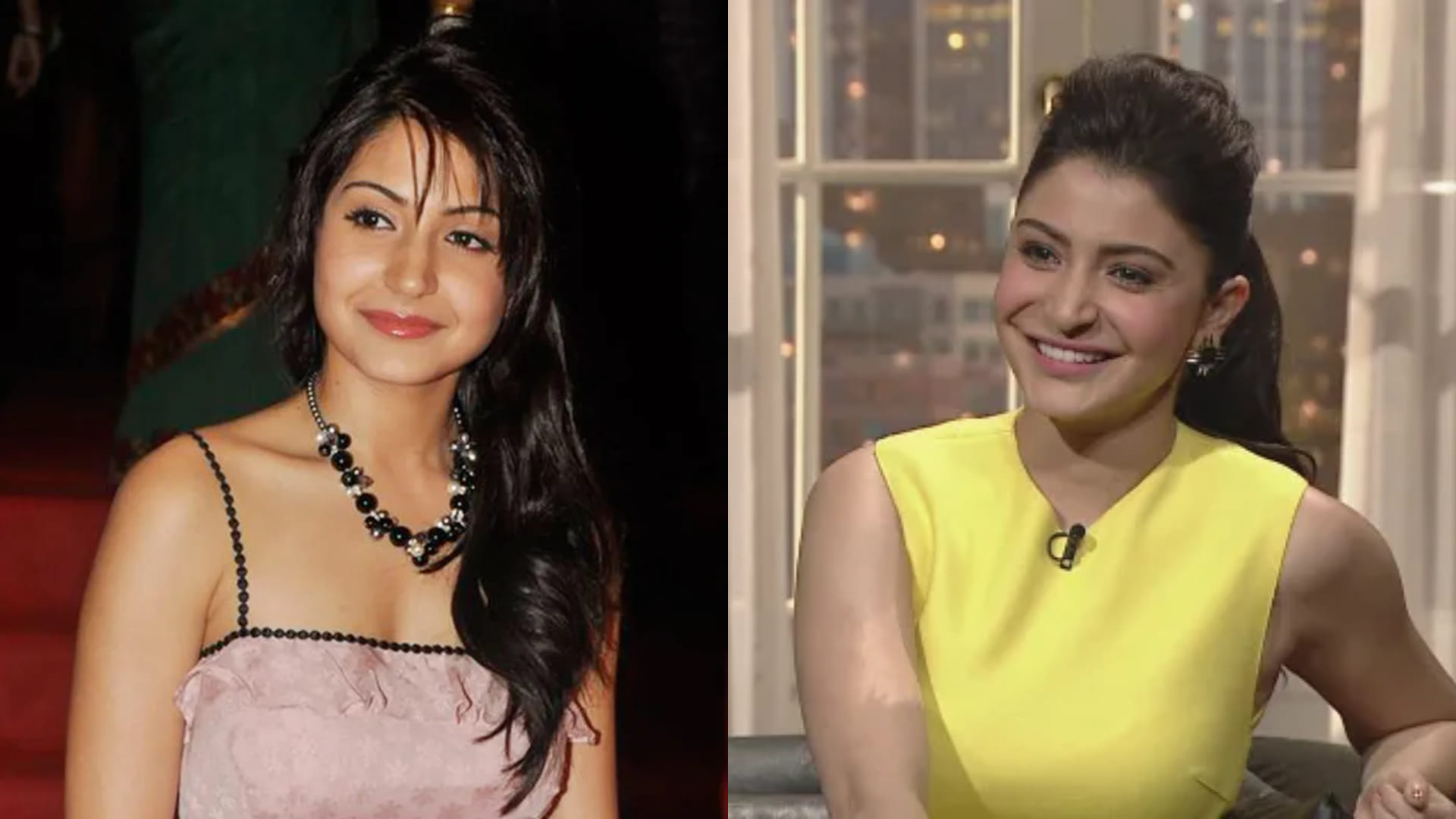 Actress Who Have Done Plastic Surgery Koena Mitra Anushka Sharma Shruti Hasan Shilpa Shetty Rakhi Sawant