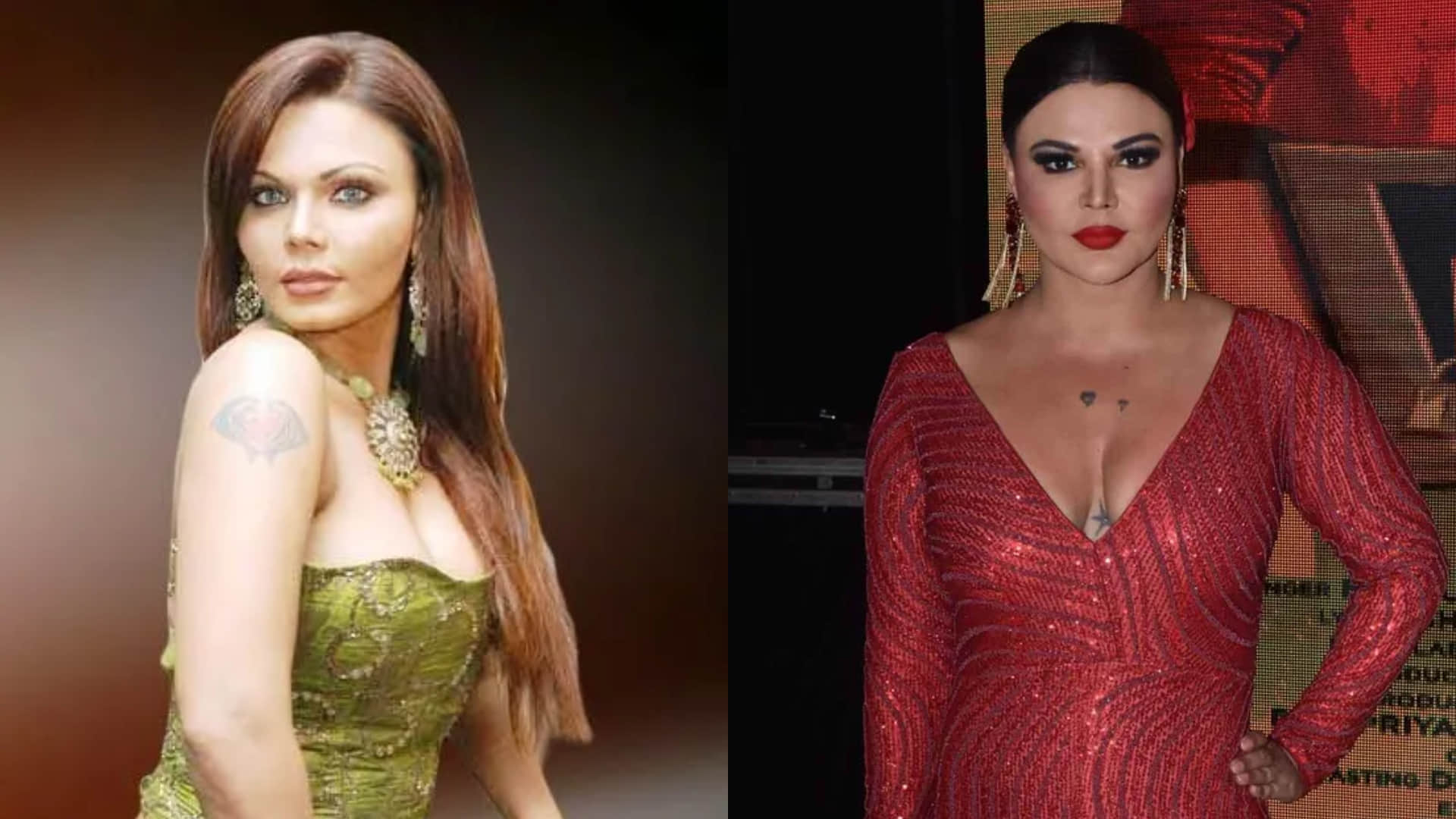 Ayesha Takia shilpa shetty to rakhi sawant and many other celebrities choose Plastic surgery to look beautiful and young